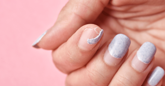 Preventing And Treating Splitting, Cracking Nails: Expert Advice - elonessentials.com