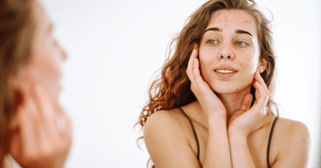 Signs Your Skin Is Dehydrated and What to Do About It - elonessentials.com