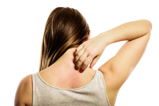 Do You Suffer From Dry, Chafing, Or Chapped Skin? Try Elon Skin Repair System
