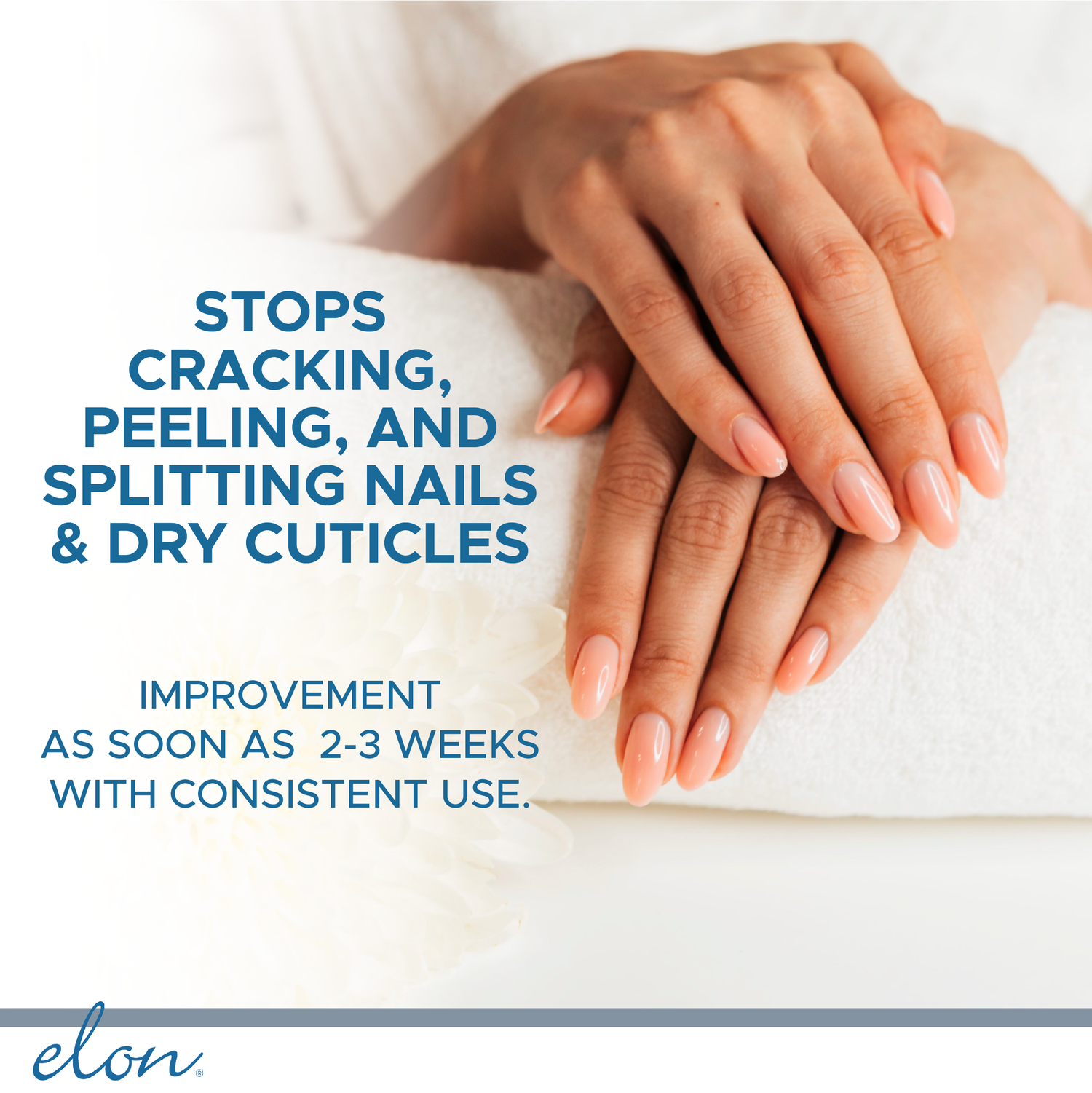 How To Heal Dry Cracked Hands, Fingertips & Cuticles - Natural Skin Revival