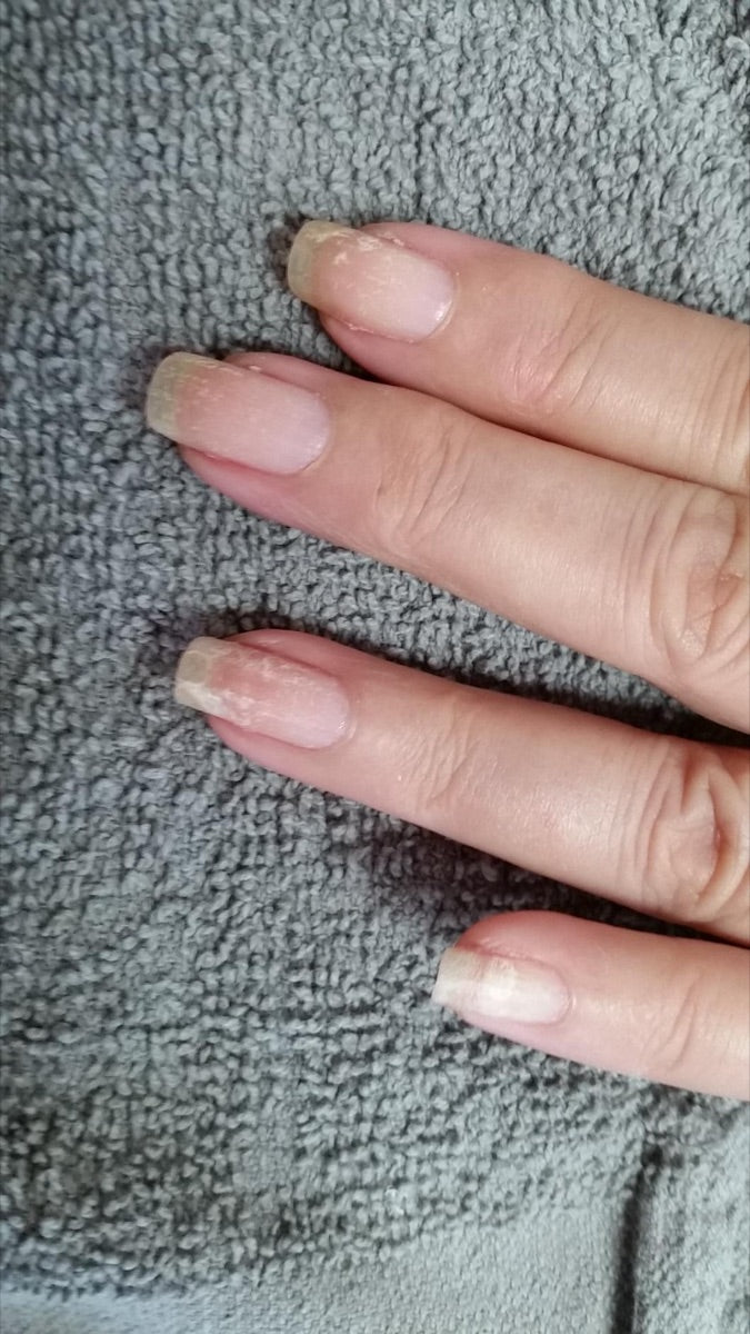 Nails before