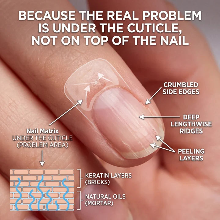The nail matrix beneath the cuticle